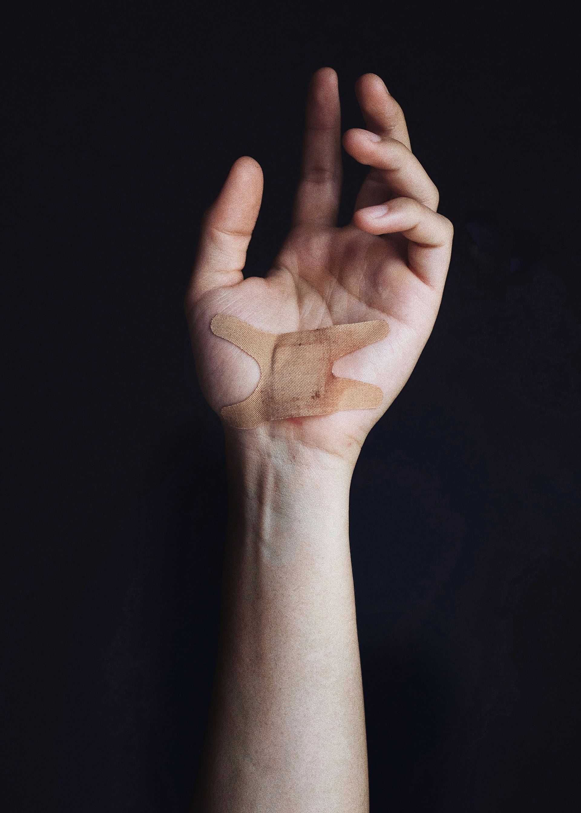 cuts and grazes