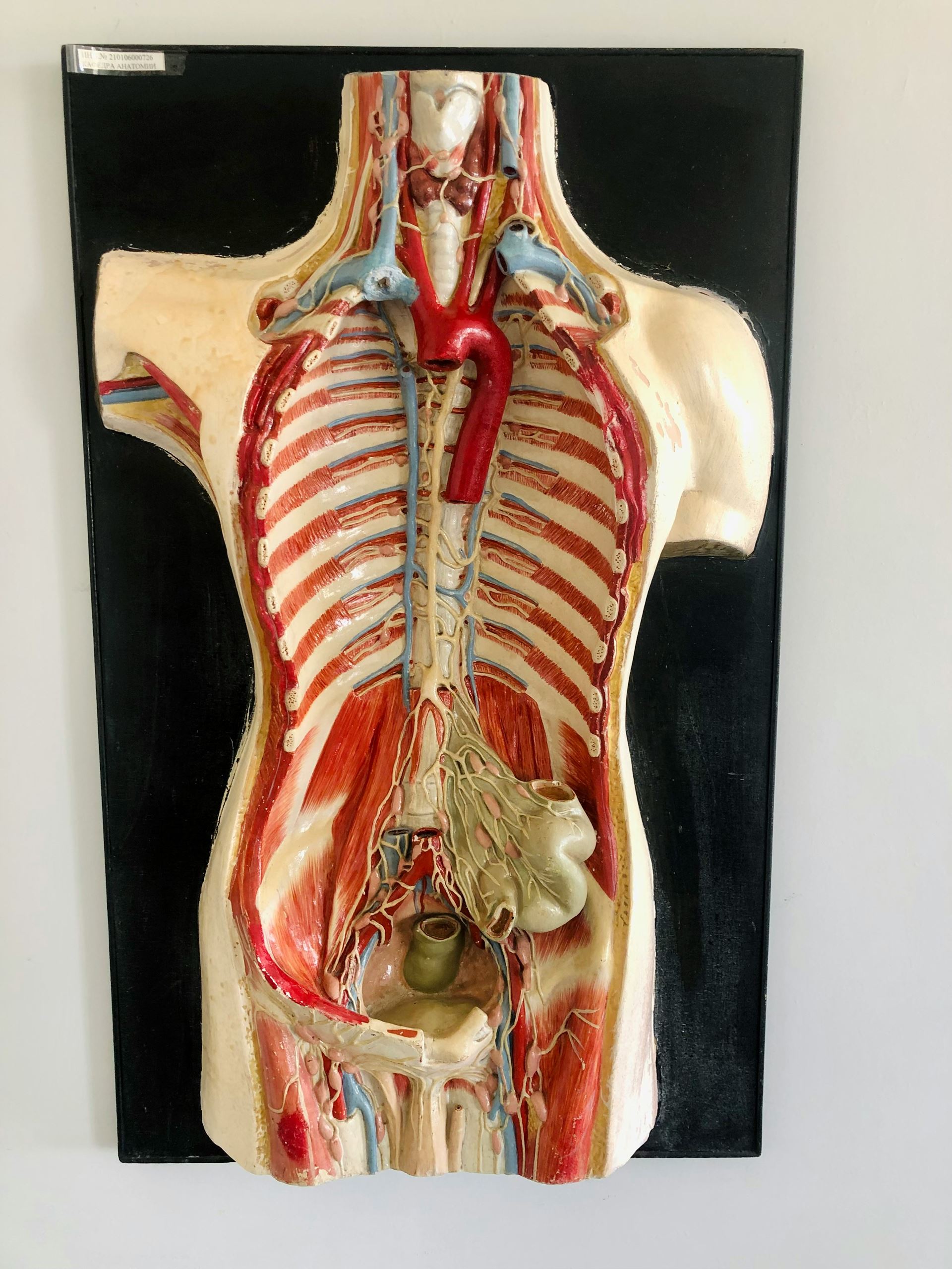 muscle diagram