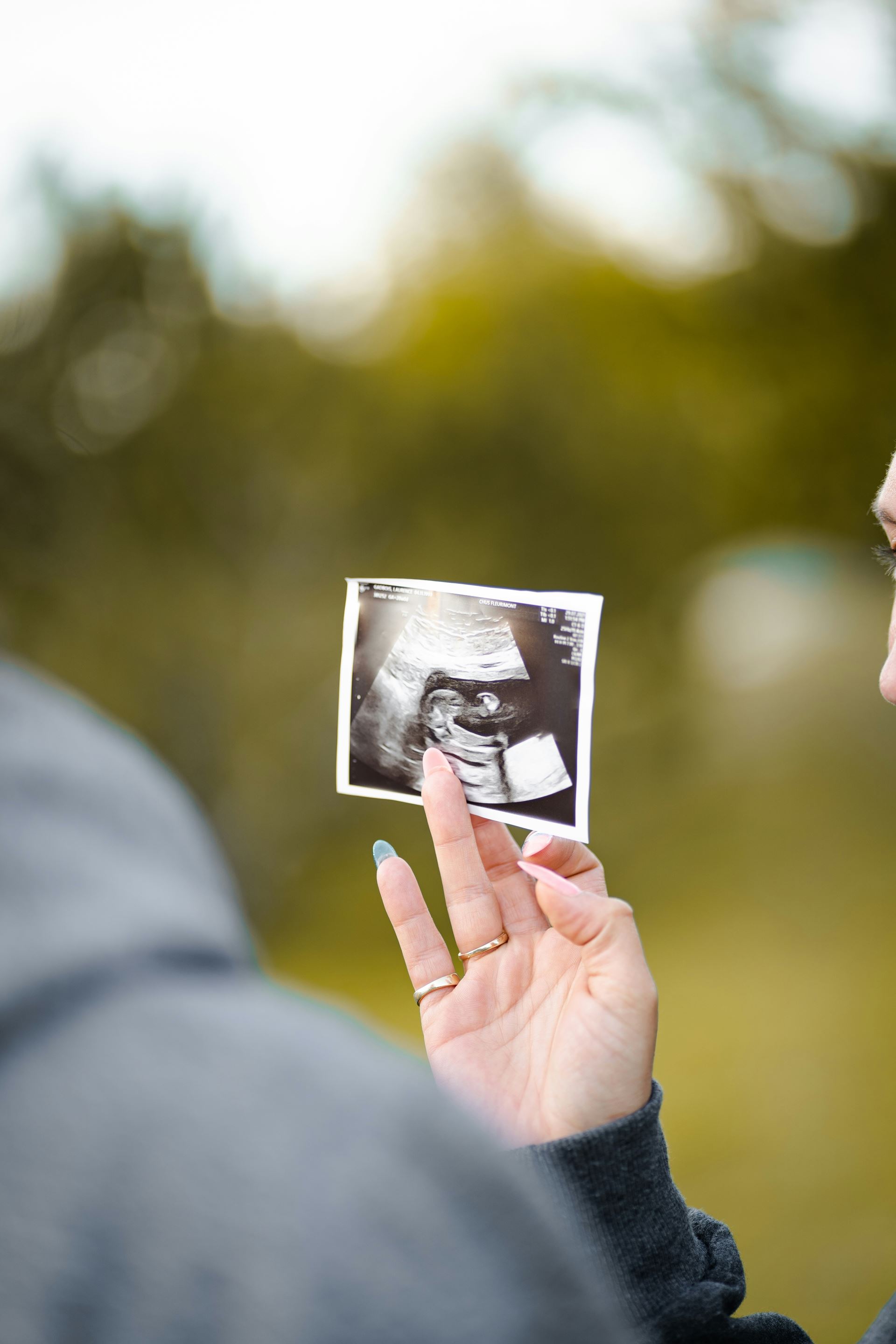 Maternity Services 